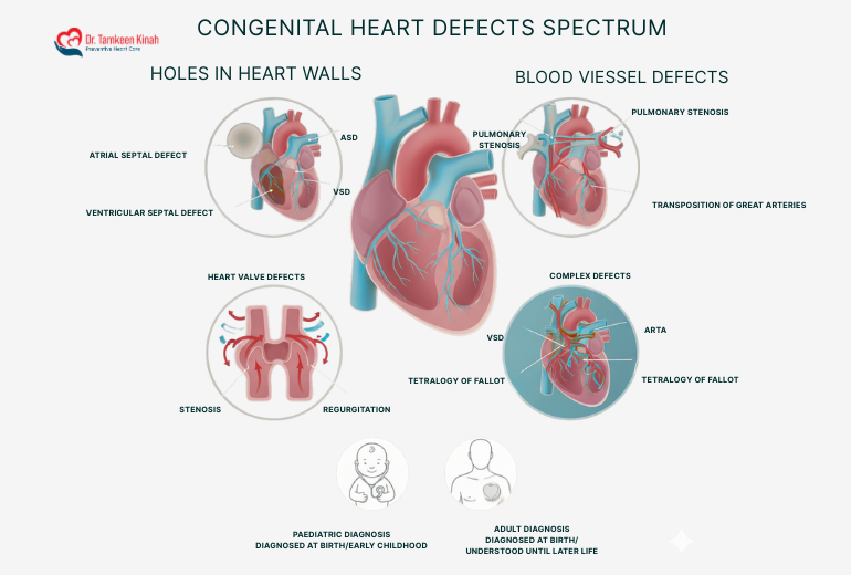Spectrum Of Congenital Heart Defects